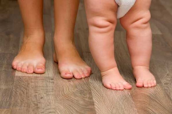 Déformation valgus chez les enfants