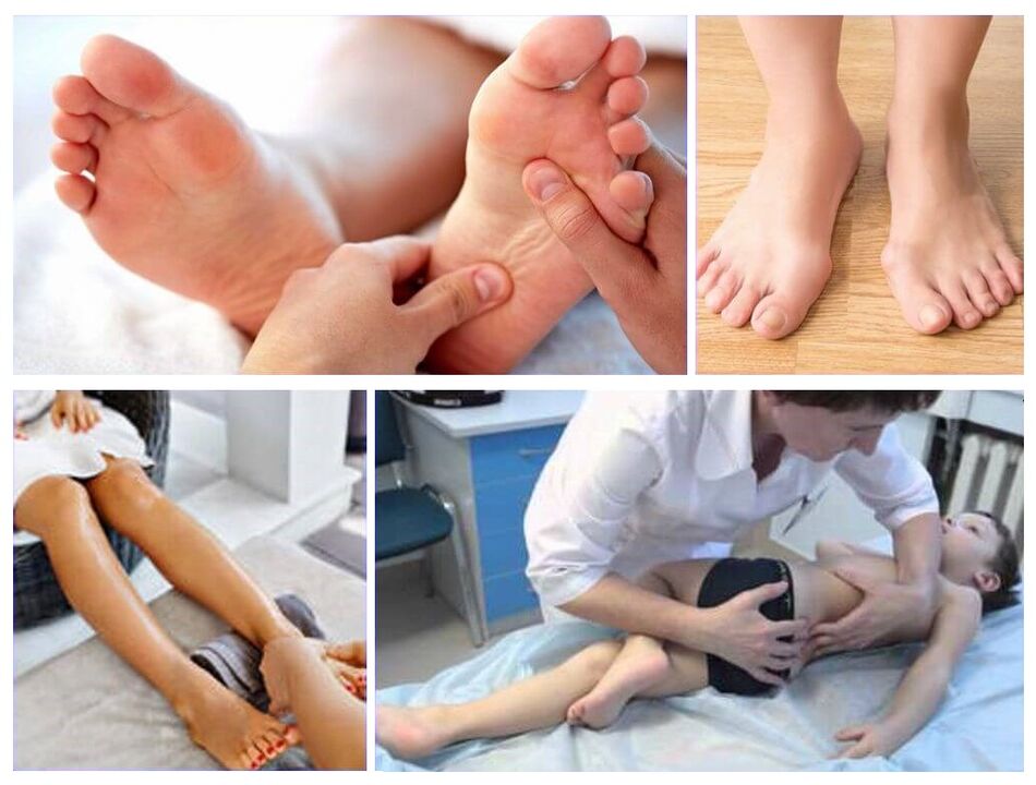 Déformation valgus dans le traitement des enfants
