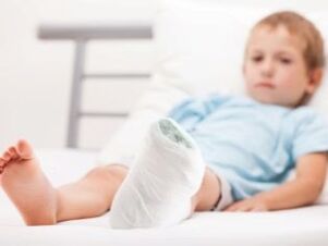Les causes de la déformation