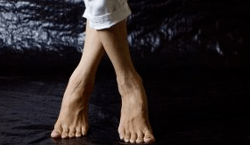Déformation valgus