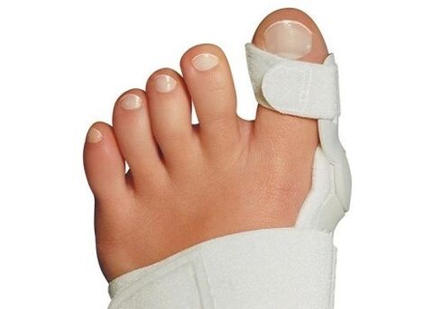Déformation valgus