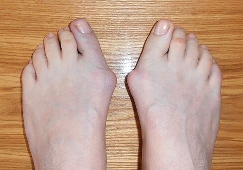 Factures sur les pieds